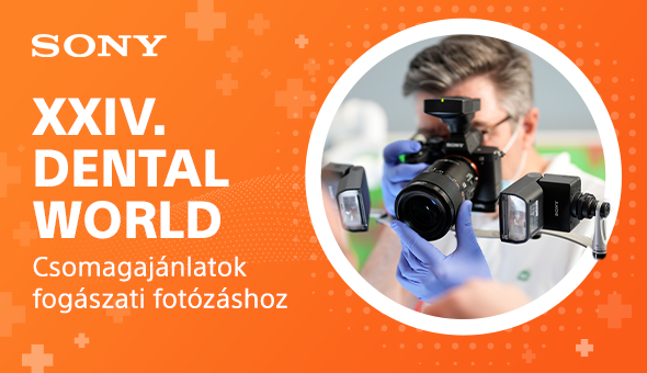 Sony csomagajánlatok